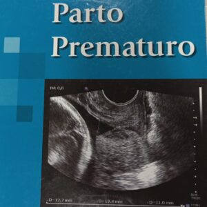 PARTO PREMATURO