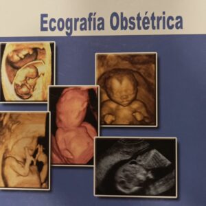 ECOGRAFIA OBSTETRICA